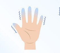 Priznaky-polyneuropatie--330x186